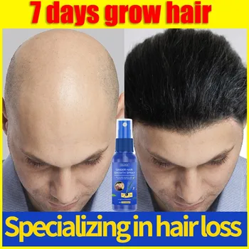 10PCS ג ' ינג ' ר צמיחת השיער ספריי יעיל טיפול להתקרחות תורשתית נשירת שיער נשירת שיער לאחר לידה Seborrheic נשירת שיער